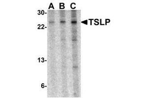 Western blot analysis of TSLP in A-20 cell lysate with TSLP antibody at (A) 0. (Thymic Stromal Lymphopoietin 抗体)