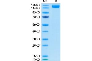 SDS-PAGE (SDS) image for SARS-CoV-2 Spike S1 (AA 16-685) protein (Fc Tag) (ABIN7274396)