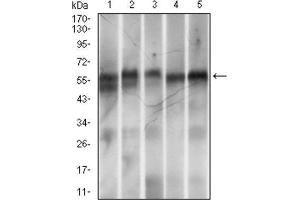 Western Blotting (WB) image for anti-Ring Finger Protein 1 (RING1) (AA 79-263) antibody (ABIN1845880) (RING1 抗体  (AA 79-263))