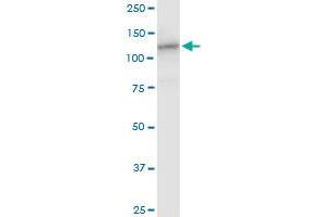 HIP1R MaxPab polyclonal antibody. (HIP1R 抗体  (AA 1-1068))