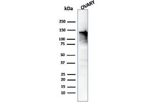 Western Blot Analysis of human Ovary tissue using Caldesmon Mouse Monoclonal Antibody (h-CALD). (Caldesmon 抗体)