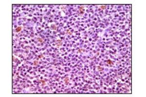 Immunohistochemistry (IHC) image for anti-Induced Myeloid Leukemia Cell Differentiation Protein Mcl-1 (MCL1) antibody (ABIN1844302) (MCL-1 抗体)