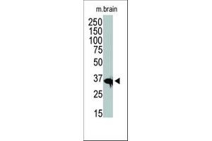 Image no. 1 for anti-Histone Deacetylase 11 (HDAC11) (C-Term) antibody (ABIN356660)