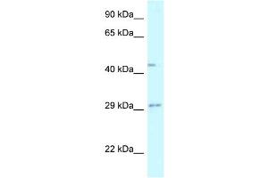 WB Suggested Anti-FUT8 Antibody Titration: 1. (FUT8 抗体  (N-Term))