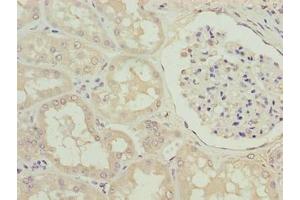 Immunohistochemistry of paraffin-embedded human kidney tissue using ABIN7170448 at dilution of 1:100 (SPACA1 抗体  (AA 30-221))