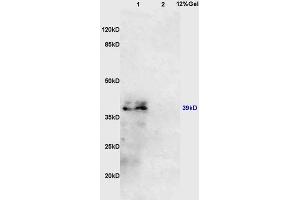 Lane 1: mouse kidney lysates Lane 2: mouse lung lysates probed with Anti AVPR2 Polyclonal Antibody, Unconjugated (ABIN747848) at 1:200 in 4 °C. (IL10RB 抗体  (AA 21-120))