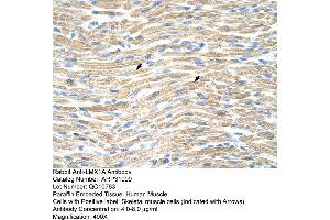 Rabbit Anti-LMX1A Antibody  Paraffin Embedded Tissue: Human Muscle Cellular Data: Skeletal muscle cells Antibody Concentration: 4. (LMX1A 抗体  (Middle Region))