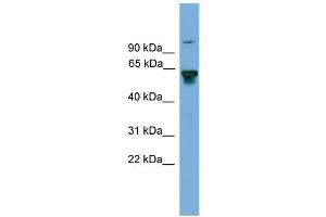 WB Suggested Anti-BIN2 Antibody Titration: 0. (BIN2 抗体  (Middle Region))