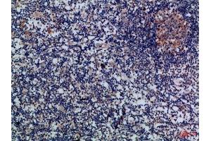 Immunohistochemical analysis of paraffin-embedded Human-lymph, antibody was diluted at 1:100 (GZMM 抗体  (AA 207-256))