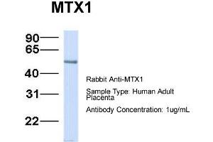 Host:  Rabbit  Target Name:  MTX1  Sample Type:  Human Adult Placenta  Antibody Dilution:  1. (Metaxin 1 抗体  (C-Term))
