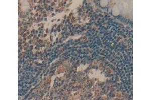 IHC-P analysis of Human Tissue, with DAB staining. (LAT 抗体  (AA 25-221))