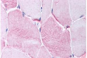 Human Skeletal Muscle (formalin-fixed, paraffin-embedded) stained with CACNG1 antibody ABIN214733 at 10 ug/ml followed by biotinylated goat anti-rabbit IgG secondary antibody ABIN481713, alkaline phosphatase-streptavidin and chromogen. (CACNG1 抗体  (AA 66-115))