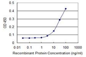 Detection limit for recombinant GST tagged TUBB is 1 ng/ml as a capture antibody. (TUBB 抗体  (AA 1-444))