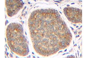 Image no. 1 for anti-Tumor Necrosis Factor (Ligand) Superfamily, Member 13 (TNFSF13) antibody (ABIN465418) (TNFSF13 抗体)