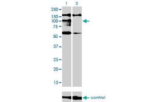 Western blot analysis of NBR1 over-expressed 293 cell line, cotransfected with NBR1 Validated Chimera RNAi (Lane 2) or non-transfected control (Lane 1). (NBR1 抗体  (AA 2-96))
