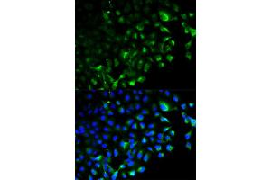 Immunofluorescence analysis of HeLa cell using TRAF2 antibody. (TRAF2 抗体)