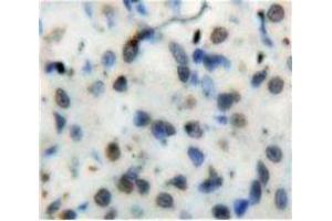 Used in DAB staining on fromalin fixed paraffin-embedded Stomach tissue (Nuclear Factor kappa B2 (AA 38-343) 抗体)
