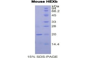 SDS-PAGE analysis of Mouse Hexosaminidase B beta Protein. (HEXB 蛋白)