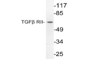Image no. 1 for anti-Transforming Growth Factor, beta Receptor II (70/80kDa) (TGFBR2) antibody (ABIN271848) (TGFBR2 抗体)