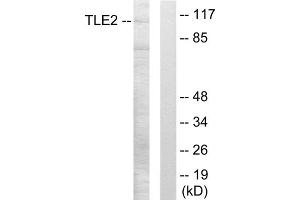 Western blot analysis of extracts from LOVO cells, using TLE2 antibody. (TLE2 抗体  (Internal Region))