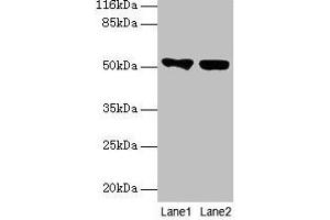 Western blot All lanes: KRT8 antibody at 2 μg/mL Lane 1: A549 whole cell lysate Lane 2: MCF-7 whole cell lysate Secondary Goat polyclonal to rabbit IgG at 1/10000 dilution Predicted band size: 54, 57 kDa Observed band size: 54 kDa (KRT8 抗体  (AA 2-483))
