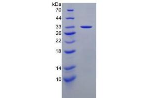 SDS-PAGE analysis of Human Laminin alpha 3 Protein. (LAMA3 蛋白)