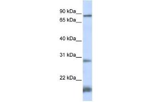 SMYD4 antibody used at 0. (SMYD4 抗体  (N-Term))