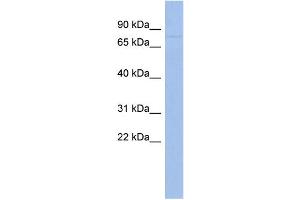 WB Suggested Anti-ZNF233 Antibody Titration:  0. (ZNF233 抗体  (Middle Region))