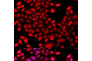 Immunofluorescence analysis of A549 cells using RARG Polyclonal Antibody
