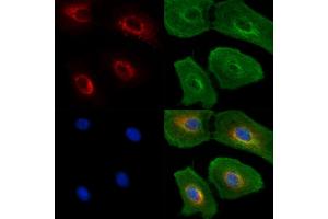 ABIN6262924 and ABIN6277599 staining  cells(UV treatment) by IF/ICC. (Lamin B Receptor 抗体  (Internal Region))