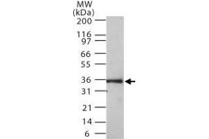 Western blot analysis of MKI67IP in 30 ugs of Ramos cell lysate. (NIFK 抗体  (AA 100-200))