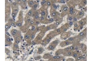 Detection of APOL2 in Human Liver Tissue using Polyclonal Antibody to Apolipoprotein L2 (APOL2) (Apolipoprotein L 2 抗体  (AA 186-337))
