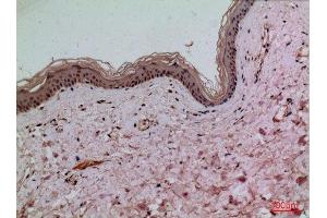 Immunohistochemistry (IHC) analysis of paraffin-embedded Human Skin, antibody was diluted at 1:100. (IL-1 beta 抗体  (Internal Region))