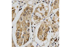 Immunohistochemistry of paraffin-embedded human stomach using MAPK10 antibody at dilution of 1:200 (x400 lens) (MAPK10 抗体)