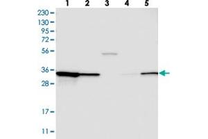 Western blot analysis of Lane 1: RT-4, Lane 2: U-251 MG, Lane 3: Human Plasma, Lane 4: Liver, Lane 5: Tonsil with STARD10 polyclonal antibody . (STARD10 抗体)