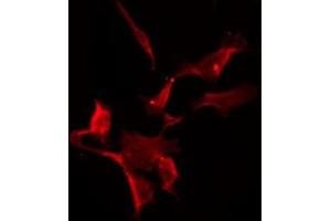 Immunofluorescence (fixed cells) (IF/ICC) image for anti-Solute Carrier Family 6 (Neurotransmitter Transporter, Creatine), Member 8 (SLC6A8) (C-Term) antibody (ABIN6259617)