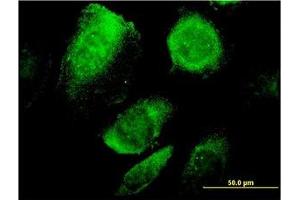Image no. 1 for anti-B-Cell Receptor-Associated Protein 29 (BCAP29) (AA 125-241) antibody (ABIN599278) (BCAP29 抗体  (AA 125-241))