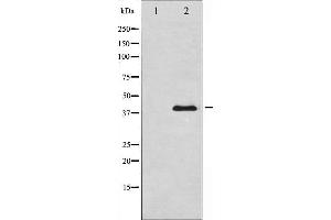 Western blot analysis of AMPK β1 expression in COS7 whole cell lysates,The lane on the left is treated with the antigen-specific peptide.