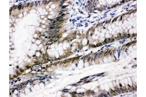 Immunohistochemistry (IHC) image for anti-Signal Transducer and Activator of Transcription 6, Interleukin-4 Induced (STAT6) (AA 13-29), (N-Term) antibody (ABIN3044265)