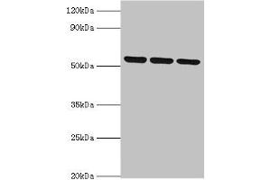 Western blot All lanes: MYOT antibody at 2 μg/mL Lane 1: 293T whole cell lysate Lane 2: HepG2 whole cell lysate Lane 3: Mouse skeletal muscle tissue Secondary Goat polyclonal to rabbit IgG at 1/10000 dilution Predicted band size: 56, 36 kDa Observed band size: 56 kDa (Myotilin 抗体  (AA 443-498))