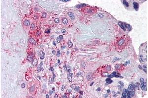 Anti-ADAMTS5 antibody  ABIN1048294 IHC staining of human placenta. (ADAMTS5 抗体  (Internal Region))