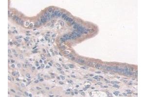 Detection of CTTN in Mouse Uterus Tissue using Polyclonal Antibody to Cortactin (CTTN) (Cortactin 抗体  (AA 1-509))