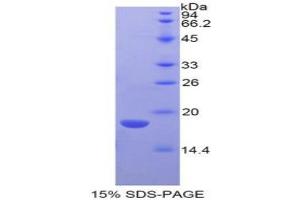 SDS-PAGE analysis of Mouse LYAR Protein. (LYAR 蛋白)