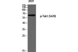 Western Blot (WB) analysis of 293T using p-Tak1 (S439) antibody. (TR4 抗体  (pSer439))