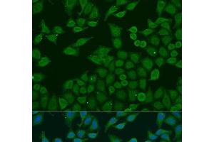 Immunofluorescence analysis of U2OS cells using PLA2G4C Polyclonal Antibody at dilution of 1:100. (PLA2G4C 抗体)