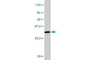 Western Blot detection against Immunogen (34. (IL23R 抗体  (AA 553-628))