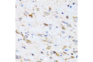 Immunohistochemistry of paraffin-embedded mouse spinal cord using PTRH2 antibody. (PTRH2 抗体  (AA 40-179))