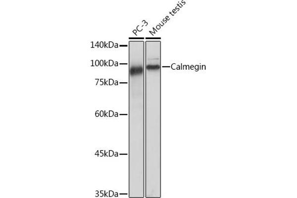 Calmegin 抗体