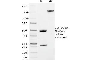 SDS-PAGE Analysis Purified IgM Mouse Monoclonal Antibody (IM373). (IGHM 抗体)
