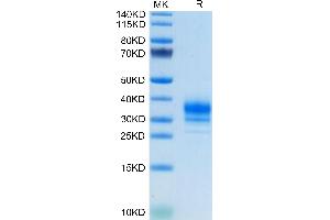 FOLR2 Protein (AA 17-228) (His tag)